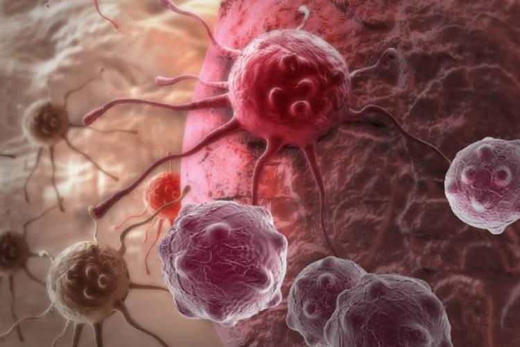 روشی نوین برای مقابله با سرطان پستان منفی سه گانه پیشنهاد شد