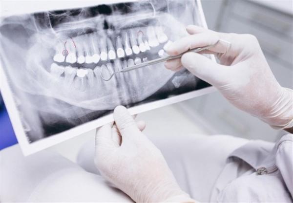 فراخوان شرکت در چالش نوآوری اصلاح سطح تجهیزات دندانپزشکی تیتانیومی و فولادی با پوشش DLC